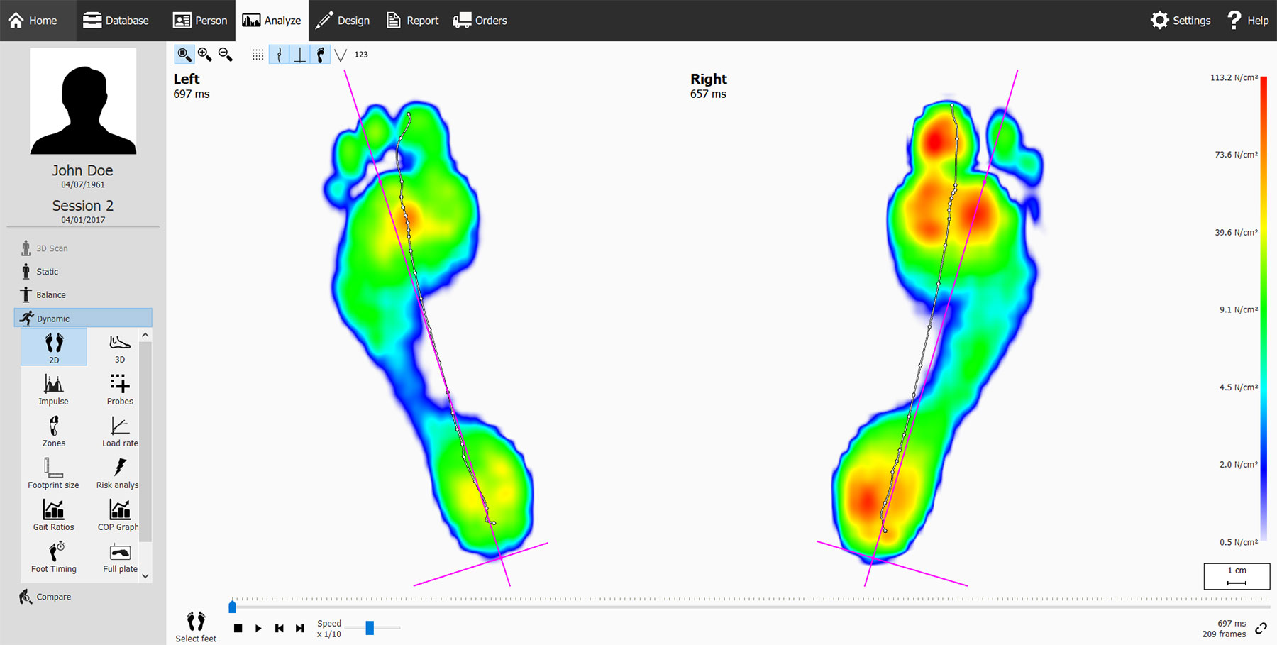 Gait Analysis